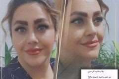 جراحی-بینی-4