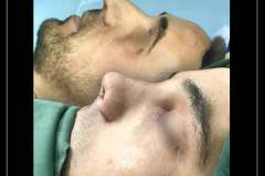 جراحی-بینی-68.jpg