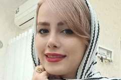 جراحی-بینی-71.jpg