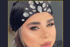 جراحی-بینی-93