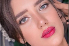 1_rhinoplasty-160
