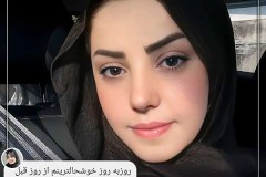 rhinoplasty-157