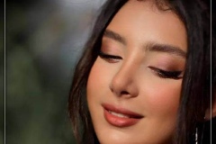 rhinoplasty-163