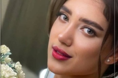rhinoplasty-164