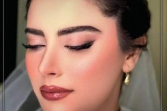 rhinoplasty-167