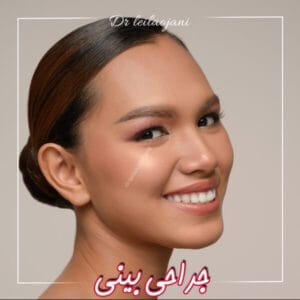 جراحی بینی در چالوس - دکتر اوجانی