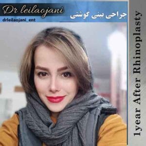 جراحی بینی گوشتی