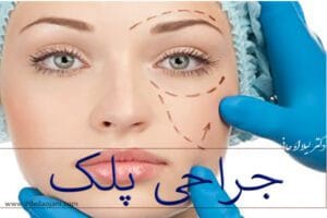 جراحی پلک - دکتر لیلا اوجانی