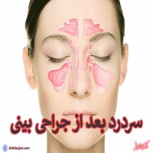 سردرد بعد از جراحی بینی - دکتر لیلا اوجانی