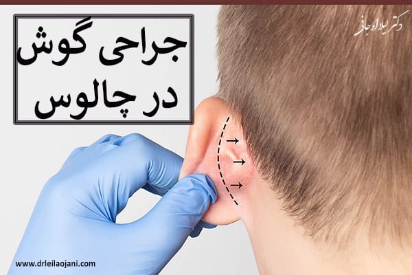 جراحی گوش در چالوس - دکتر لیلا اوجانی
