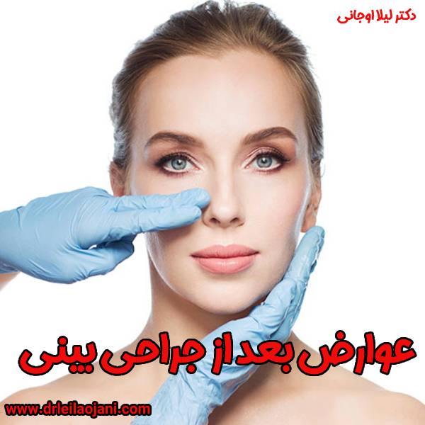 عکس عوارض بعد از جراحی بینی