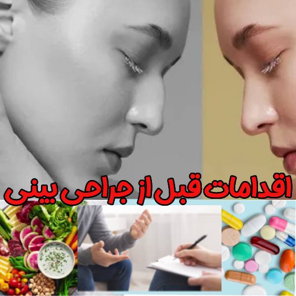 عکس اقدامات قبل از جراحی بینی - دکتر لیلا اوجانی