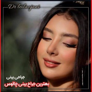 عکس نمونه کار جراحی بینی - بهترین جراح بینی چالوس