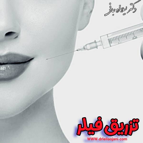 عکس تزریق فیلر