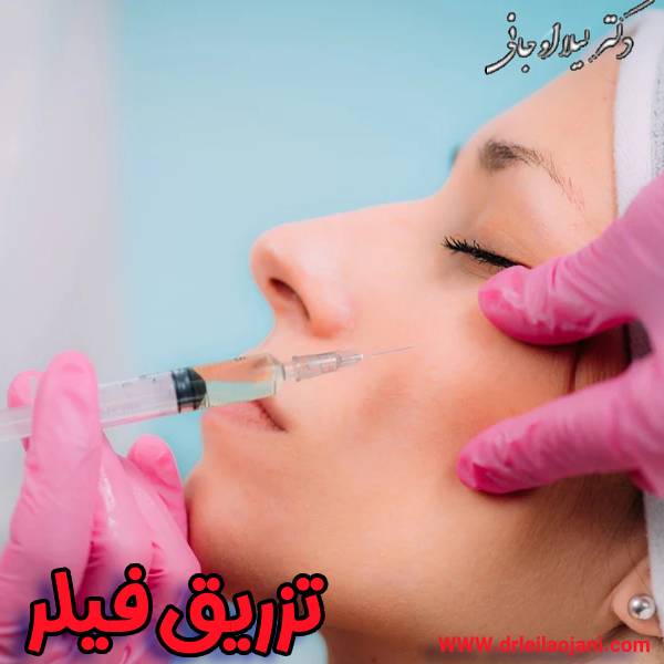 عکس تزریق فیلر