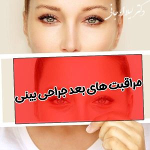 مراقبت های بعد جراحی بینی