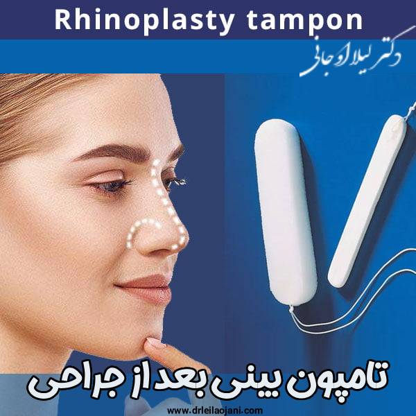 تامپون بینی بعد عمل - دکتر لیلا اوجانی
