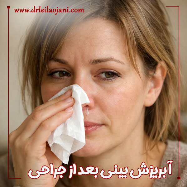 آبریزش بینی بعد از جراحی + دکتر لیلا اوجانی