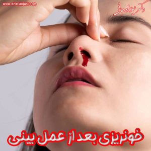 خونریزی بعد عمل بینی - دکتر لیلا اوجانی