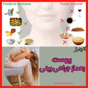 یبوست بعد عمل بینی - دکتر لیلا اوجانی