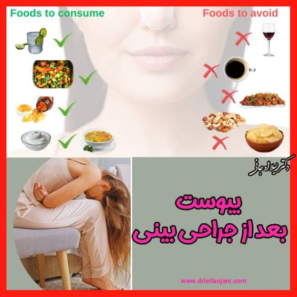 یبوست بعد عمل بینی - دکتر لیلا اوجانی